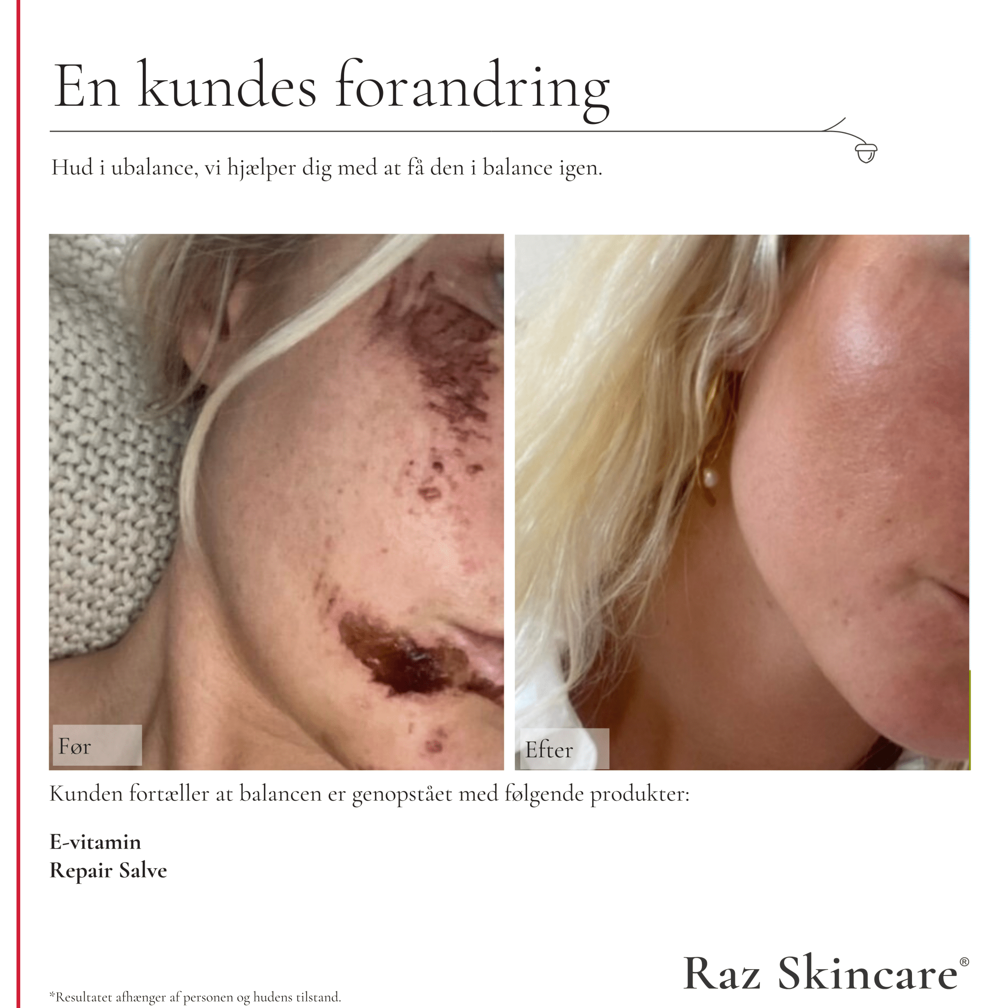 En kunde med sår i ansigtet har brugt Repair og E-vitamin og fået sårene væk