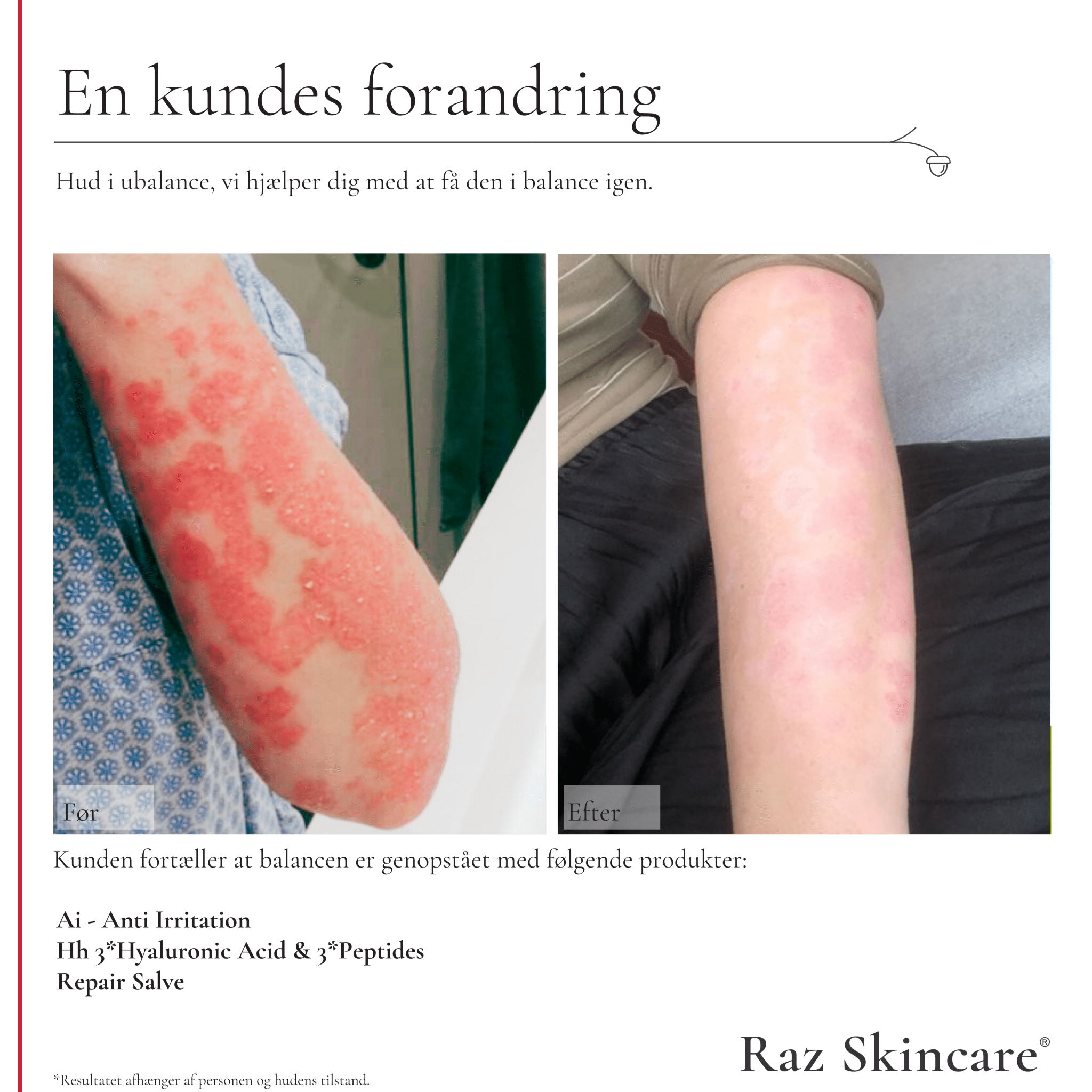 Repair Salve virkning, før og efter brug, på eksem