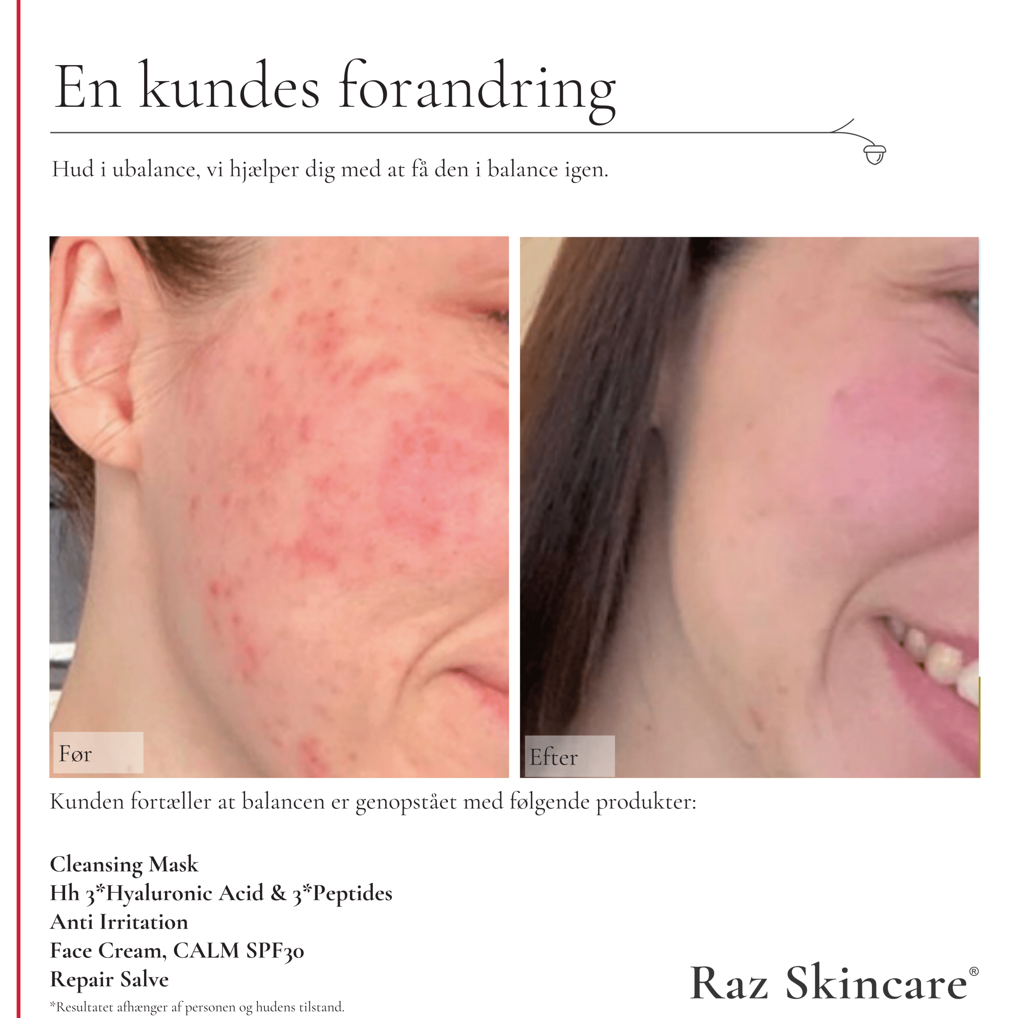 Repair Salve 15ml - Raz Skincare - før og- efter billede af kundens kind der er i ubalance, med brug af Repair salve og 4 andre produkter