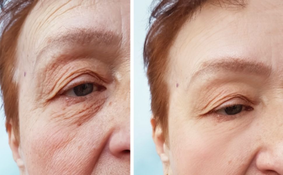 Anti-Age vinter pakke
