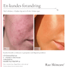 C - Vitamin 30ml - Raz Skincare