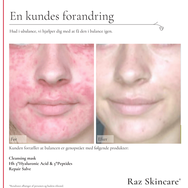 Raz Skincare - Hud & Skincare til den kræsne forbruger
