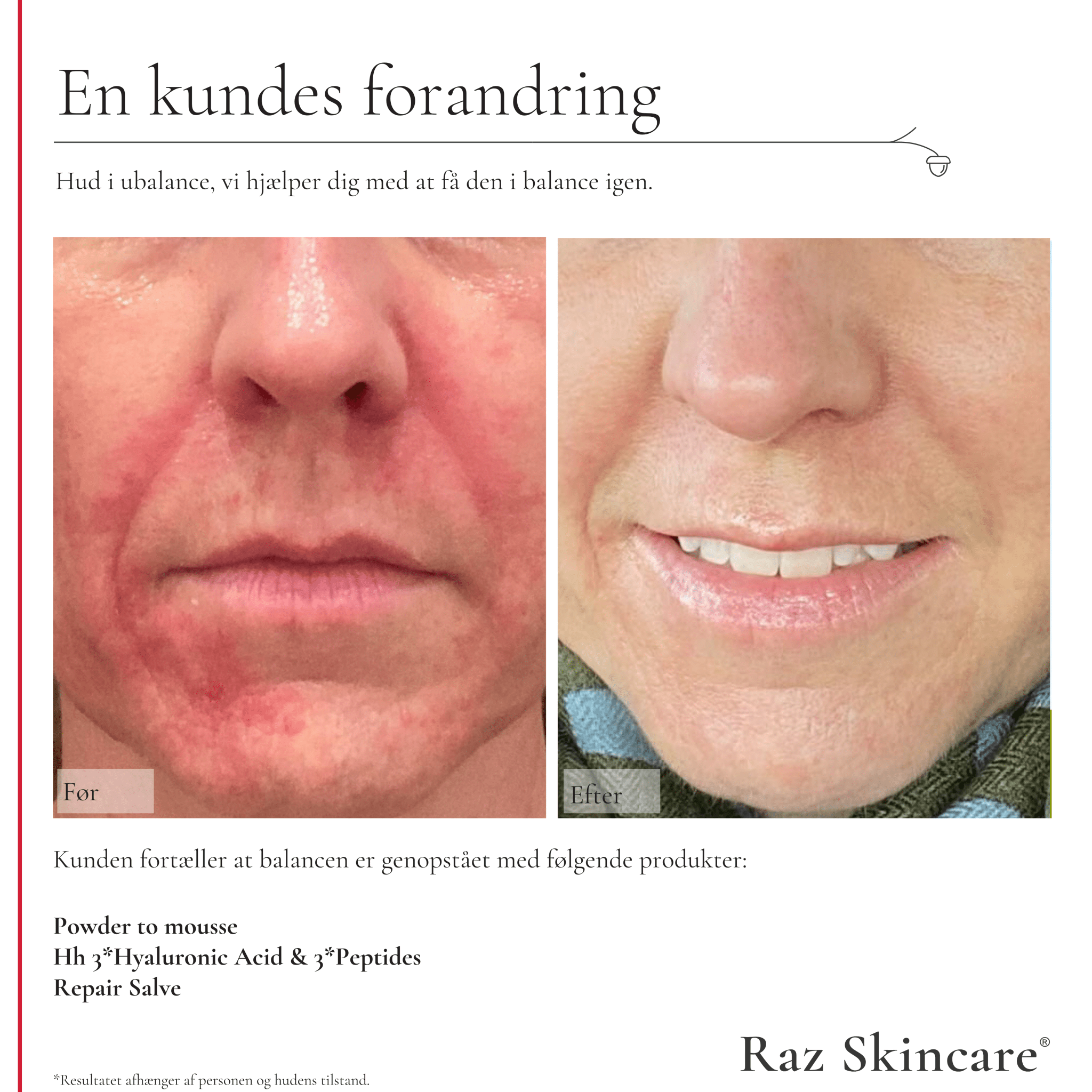 Powder to Mousse 50g - Raz Skincare