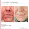 Powder to Mousse 50g - Raz Skincare