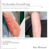 Repair Salve 100ml - Raz Skincare