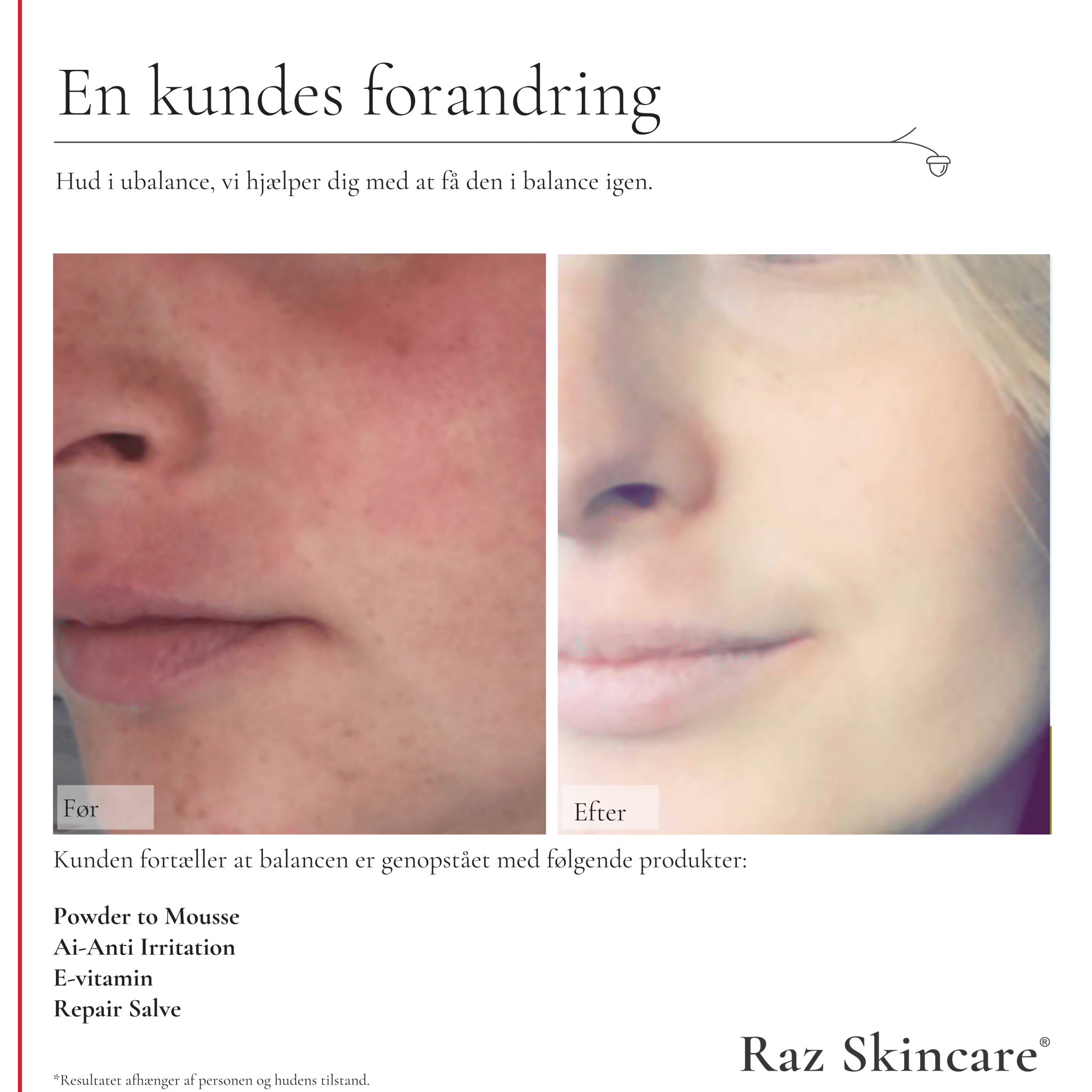 Repair Salve 15ml - Raz Skincare