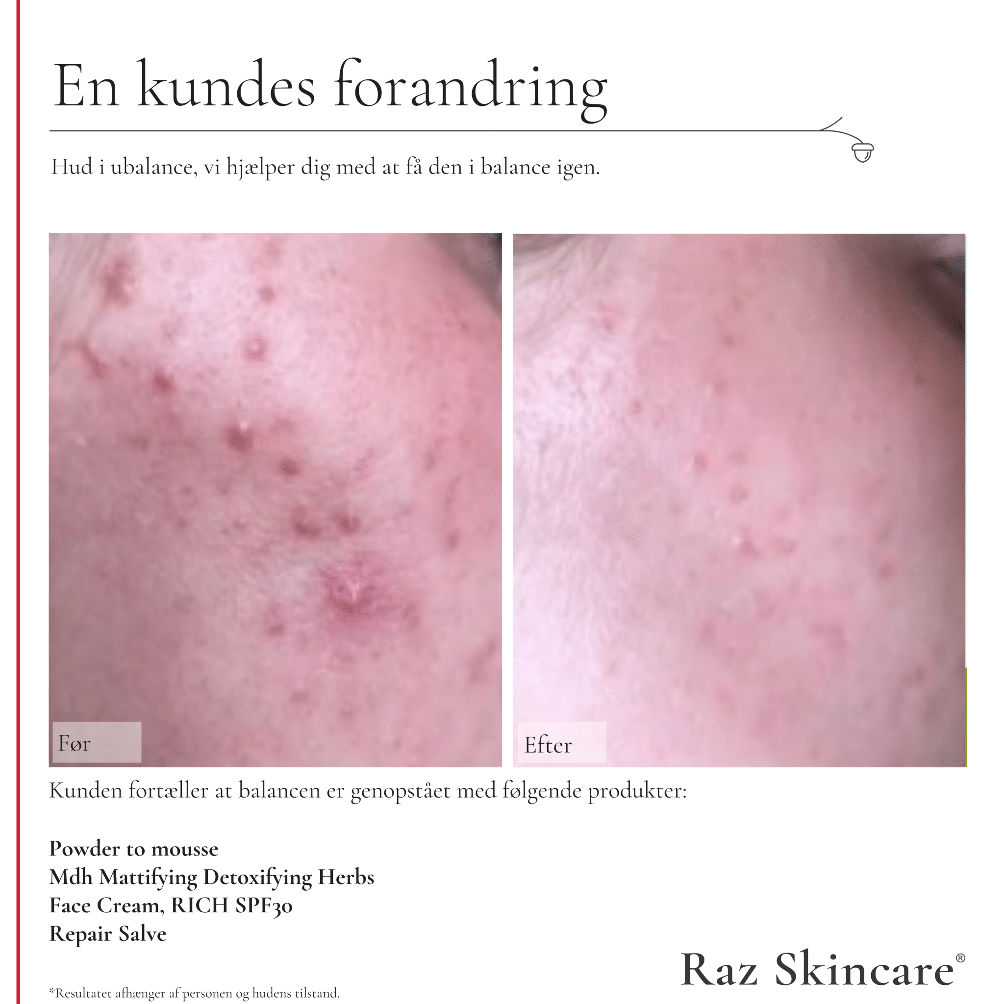 Rich Face Cream SPF 30 50ml - Raz Skincare