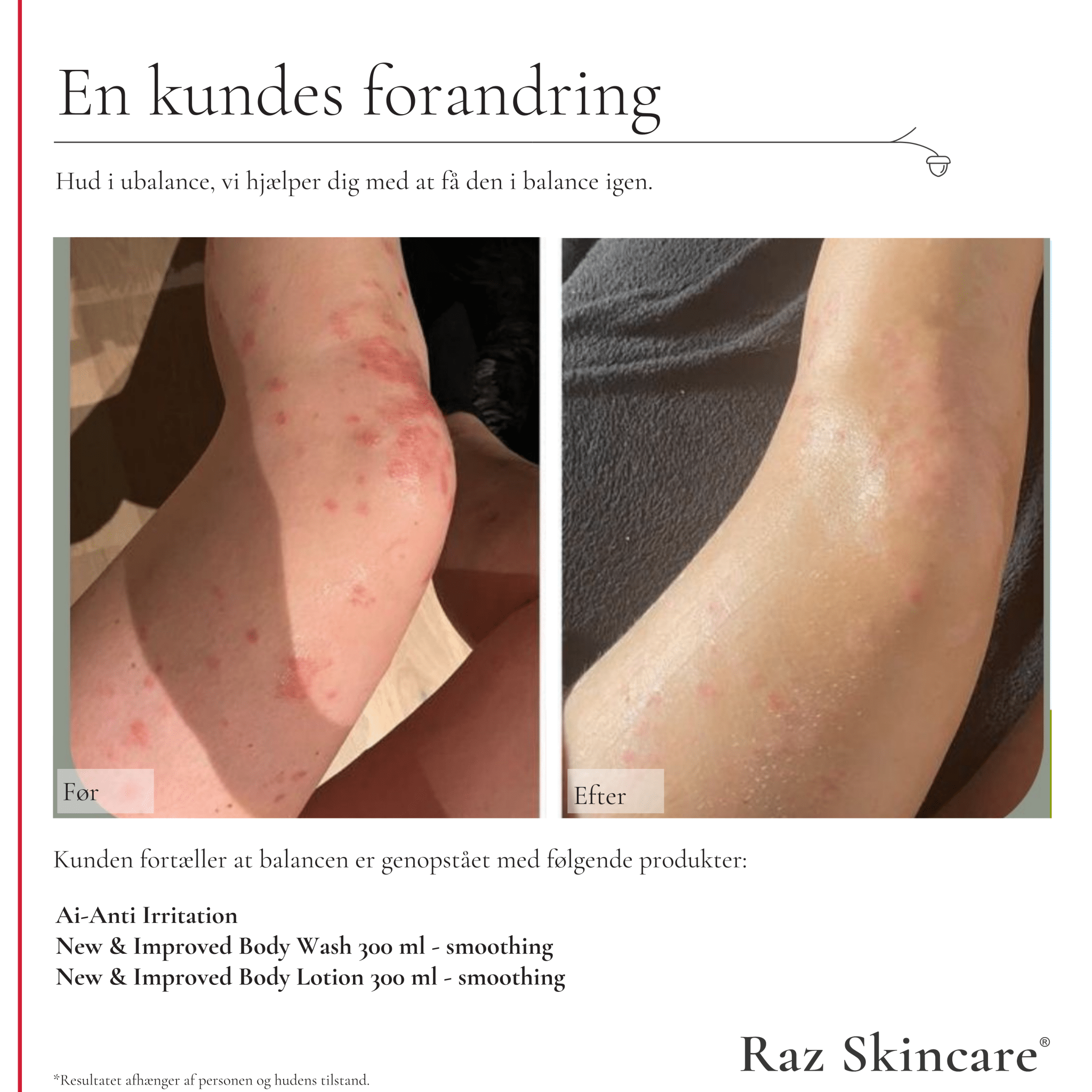 Smoothing Body Lotion (New and improved) - Raz Skincare