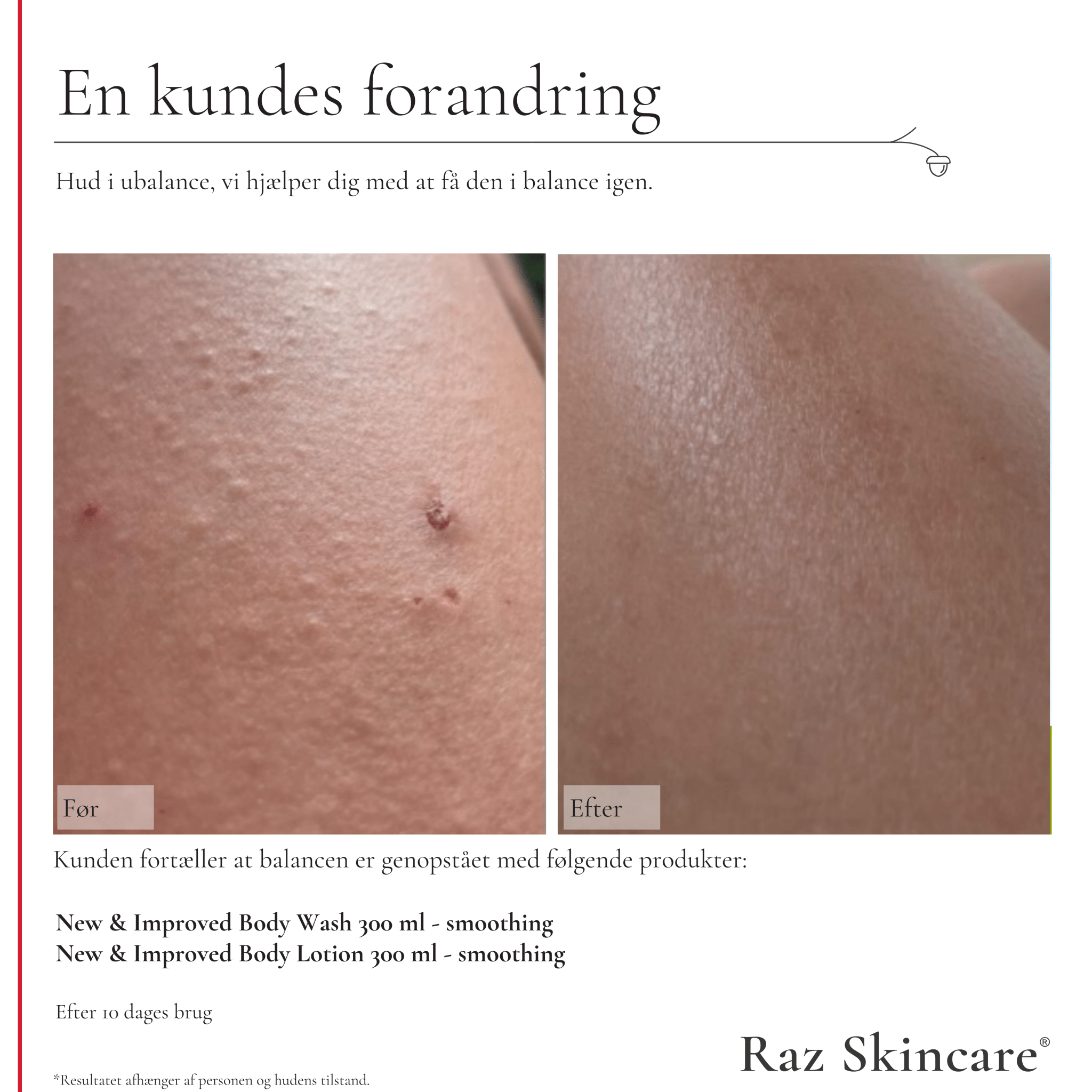 Smoothing Body Wash (New and improved) - Raz Skincare